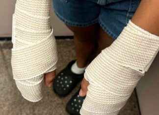 Texas Middle School Cheerleaders Suffer Burns Due to Coach’s ‘Punishment’ news-13102024-014450
