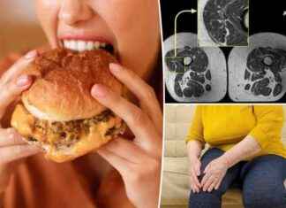 Beware: Ultra-Processed Foods Linked to Bone Disease & How to Prevent It beware-ultra-processed-foods-linked-to-bone-disease-how-to-prevent-t
