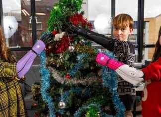Bionic Arms for Kids with Missing Limbs: The Best Christmas Gift Ever! bionic-arms-for-kids-with-missing-limbs-the-best-christmas-gift-ever