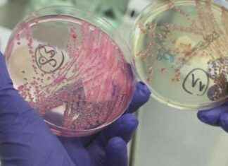 Recent E. coli Outbreak in St. Charles County: What You Need to Know recent-e-coli-outbreak-in-st-charles-county-what-you-need-to-know