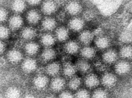 surge-in-us-cases-of-nasty-norovirus-stay-alert-and-take-precautions