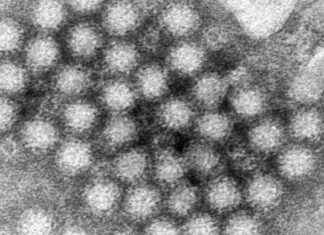 Surge in US Cases of Nasty Norovirus – Stay Alert and Take Precautions surge-in-us-cases-of-nasty-norovirus-stay-alert-and-take-precautions