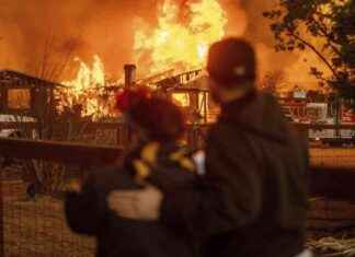 L.A. Burn Centers Prepared for Crisis During Fires la-burn-centers-prepared-for-crisis-during-fires