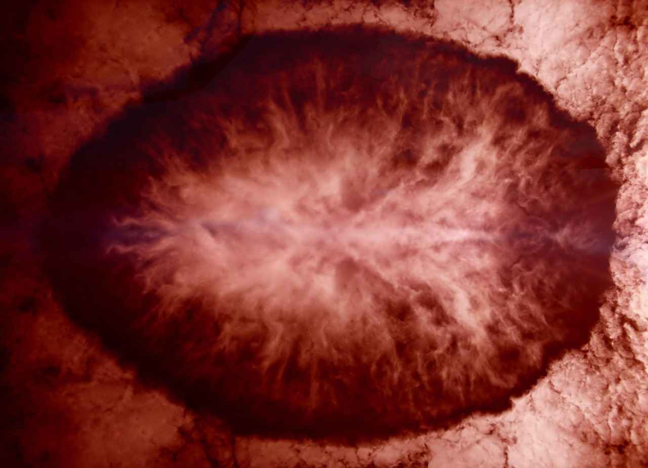 Frequently Asked Questions About Plasma Donation