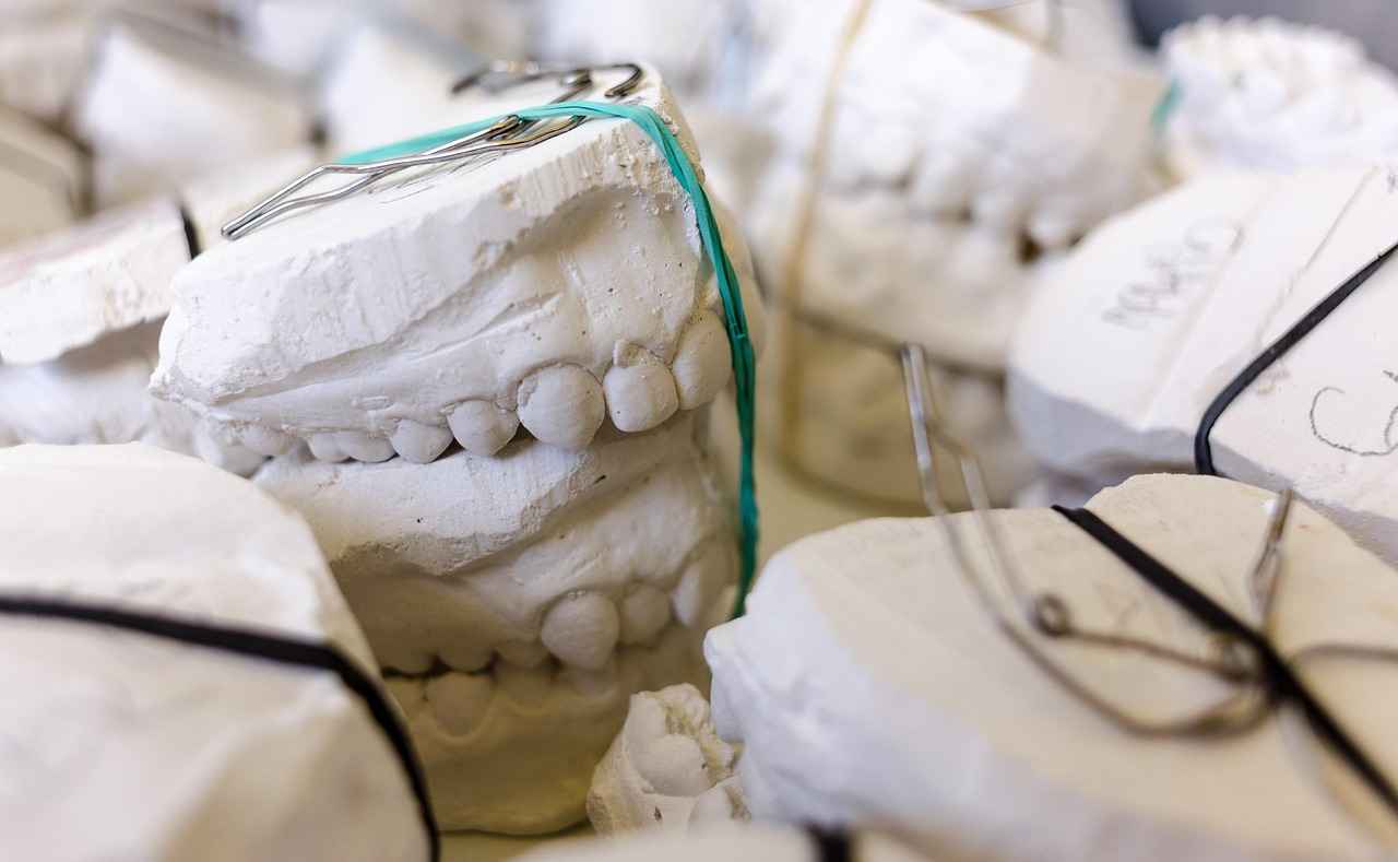 What Are the Types of Cavity Fillings?