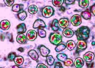 NYC Measles Outbreak: Two Confirmed Cases Reported nyc-measles-outbreak-two-confirmed-cases-reported