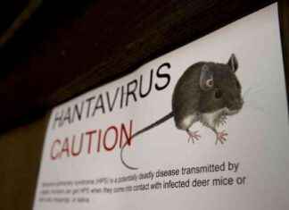 Understanding Hantavirus: Rare Disease that Killed Gene Hackman’s Wife understanding-hantavirus-rare-disease-that-killed-gene-hackmans-wife