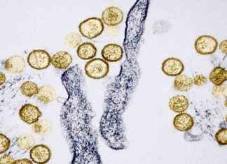 Understanding Hantavirus: Rodent-Borne Disease Linked to Gene Hackman’s Wife understanding-hantavirus-rodent-borne-disease-linked-to-gene-hackmans-wife