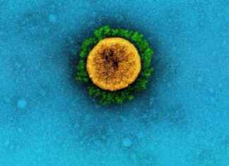 Understanding the Continued COVID-19 Deaths in the US: Causes and Solutions understanding-the-continued-covd-19-deaths-in-the-us-causes-and-solutions